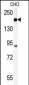ATP11C Antibody (Center)